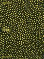 Exhibition of Yayoi Kusama